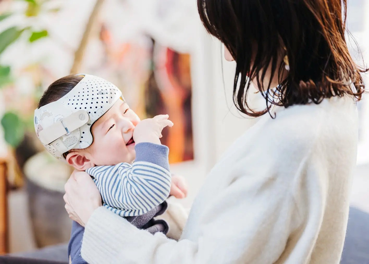 あたまの形外来のイメージ写真