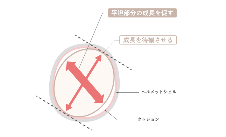 治療のしくみのイメージ写真